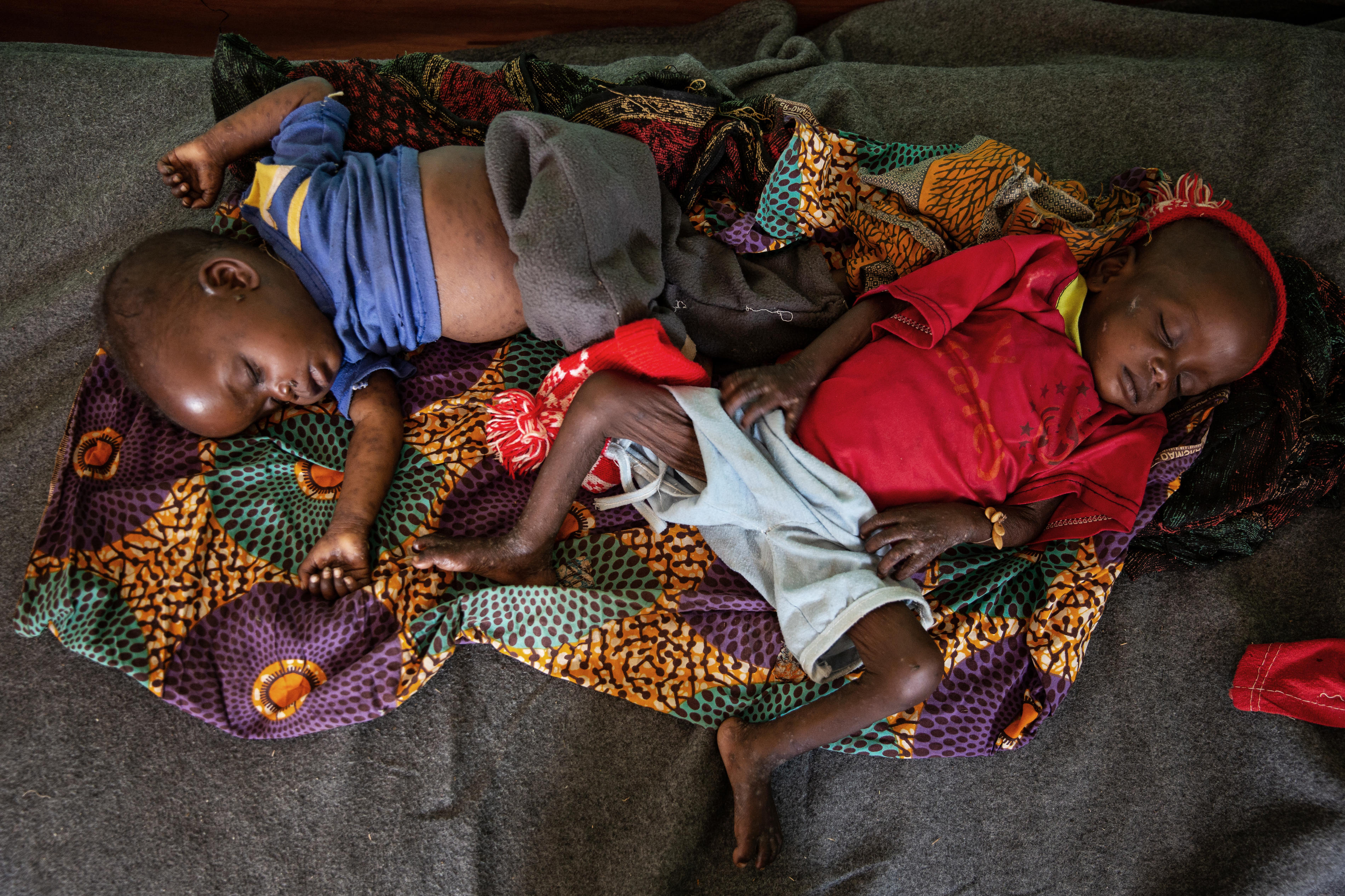 Twins Elisabeth and Sophie, were first treated for measles and then for acute malnutrition at the MSF-supported pediatric unit at the Baboua district Hospital.
