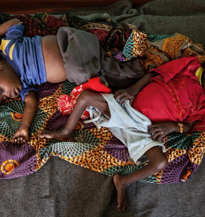 Twins Elisabeth and Sophie, were first treated for measles and then for acute malnutrition at the MSF-supported pediatric unit at the Baboua district Hospital.