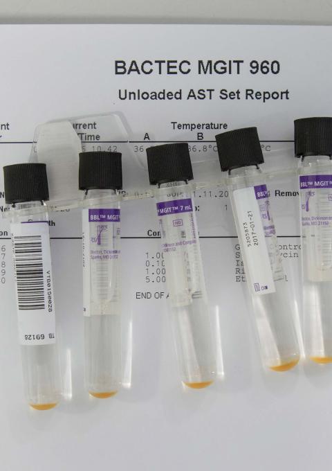 Bacteria culture tubes for BACTEC™ MGIT™ 960 Mycobacterial detection system in the National TB Reference Laboratory. This device helps growing and detecting TB bacteria and determining drug resistances. Government Hospital, Mbabane, Swaziland. Photograph by Alexis Huguet